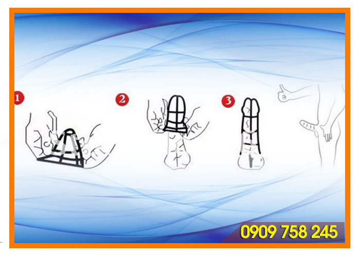 Bao cao su đôn dên gân độc đáo tăng khoái cảm cực đỉnh SHP175 Bao cao su đôn dên gân độc đáo tăng khoái cảm cực đỉnh SHP175