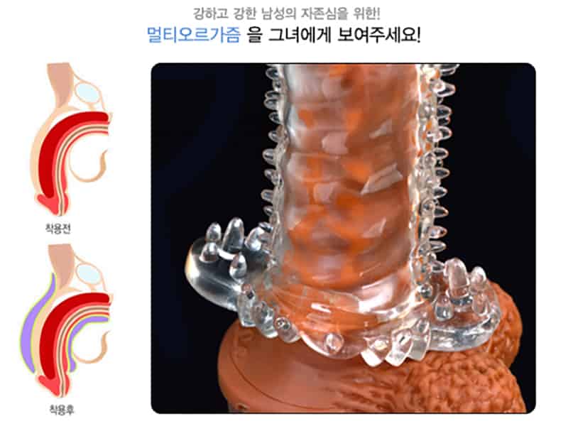 KOZA Bao Cao Su Đôn Dên Gai Lớn Mềm Mại Tăng Khoái Cảm SHP564